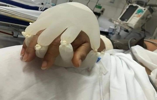 Ръката на Бога за пациенти в кома